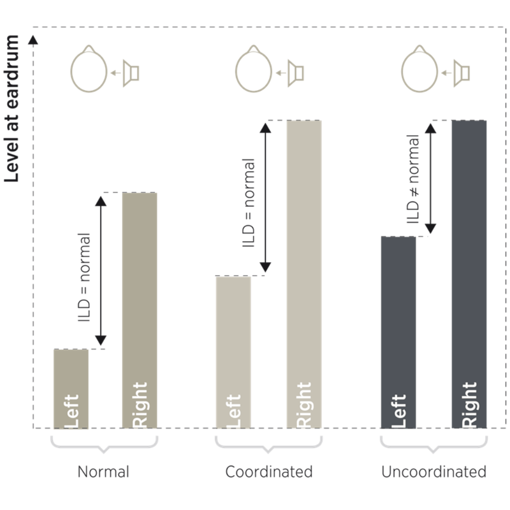Widex Technology Compression Widex Pro